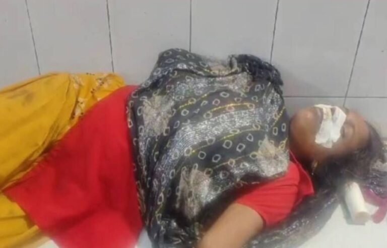 दुकान पर पहुंची महिला, बोली- मेरा 15 रुपया कब दोगे, कहा- दे देंगे, फिर काट दी नाक